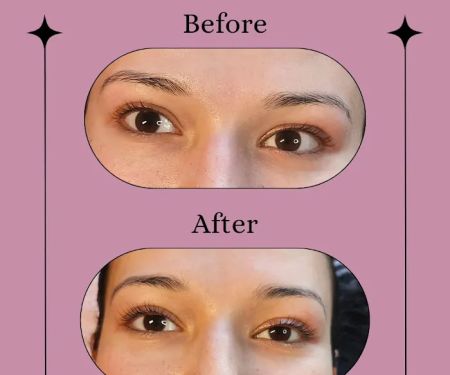 Crystal Vision Esthetics