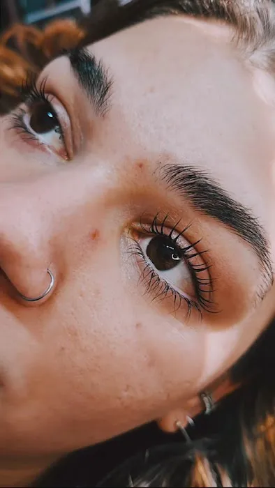 Crystal Vision Esthetics Picture 5