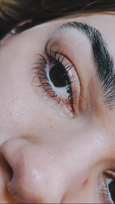 Crystal Vision Esthetics Picture 4