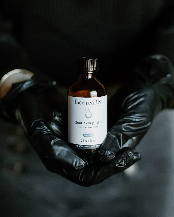 E Aesthetics and Acne Care Picture 6