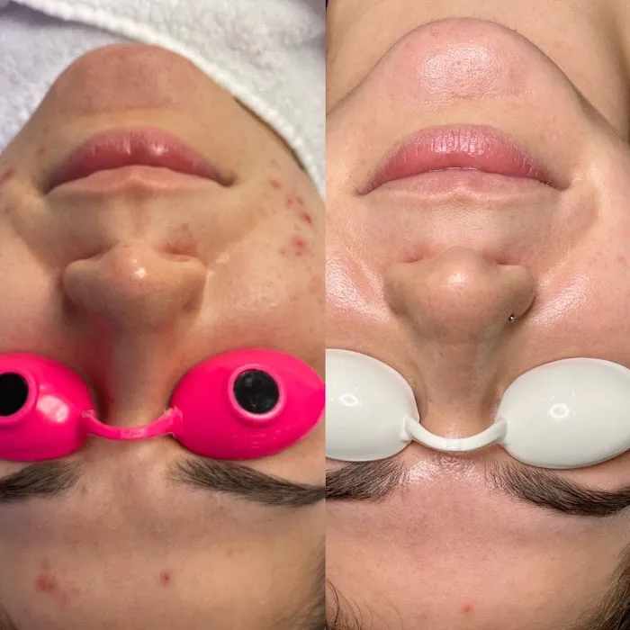 Green Skin Esthetics Picture 2