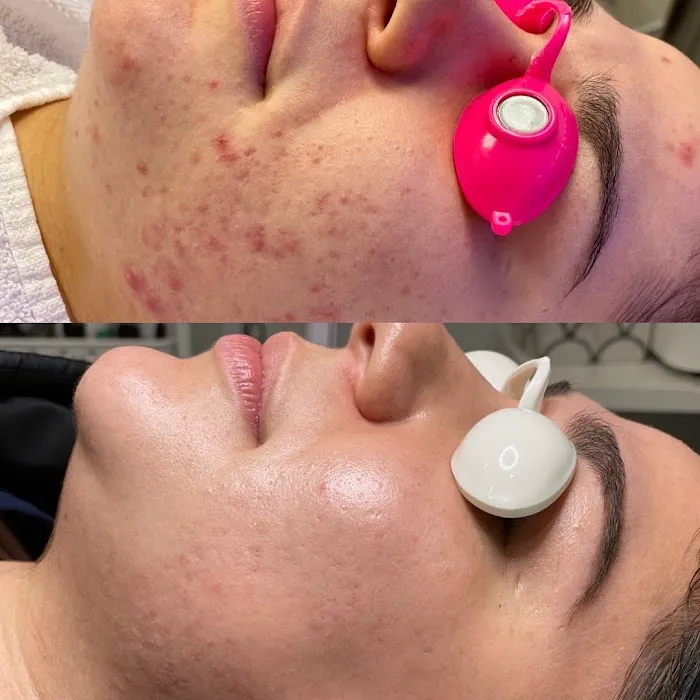 Green Skin Esthetics Picture 3