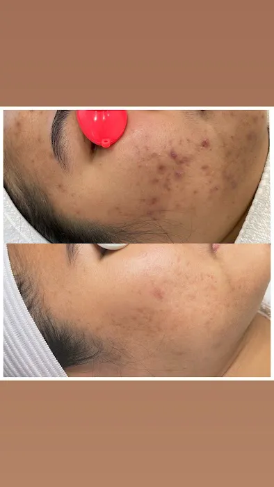 Green Skin Esthetics Picture 4