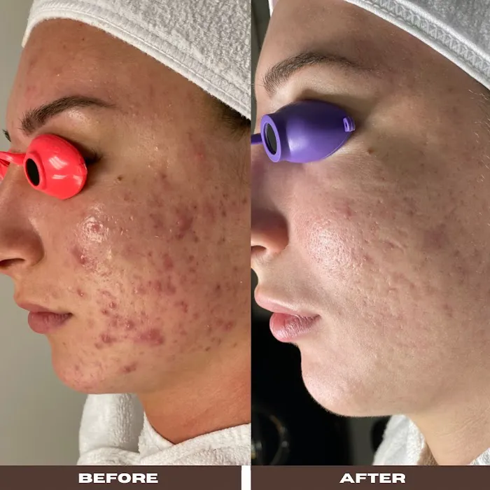 Green Skin Esthetics Picture 5