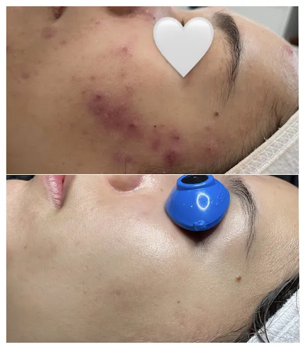 Green Skin Esthetics Picture 8