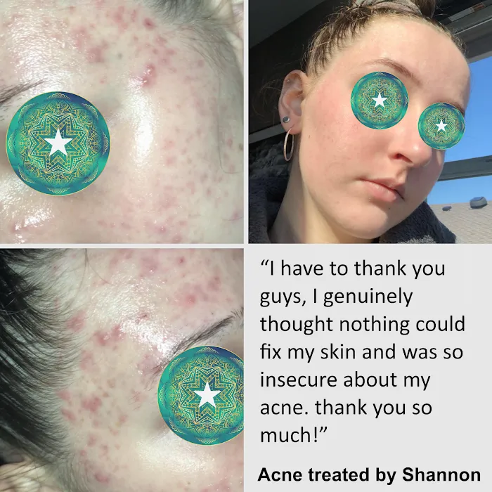 Clear Skin America Picture 10