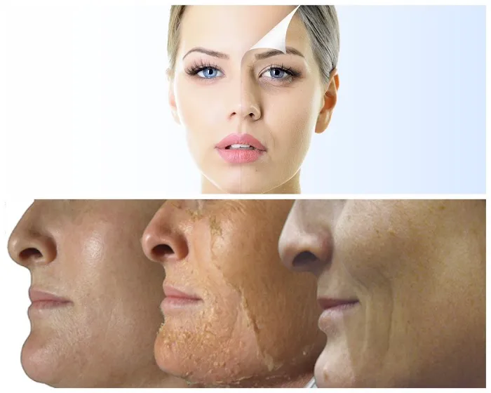 Anne Patton, Master Esthetician Picture 7