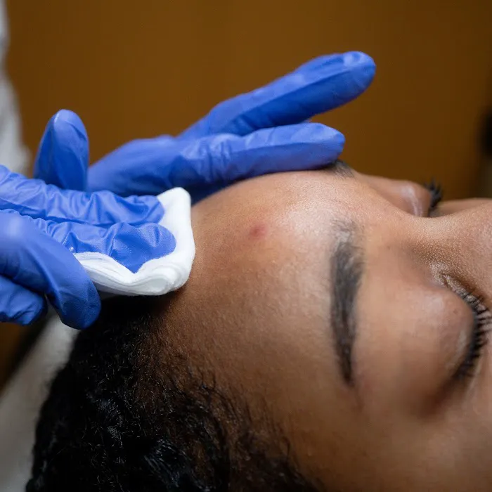 Resolution Acne Studio Picture 8