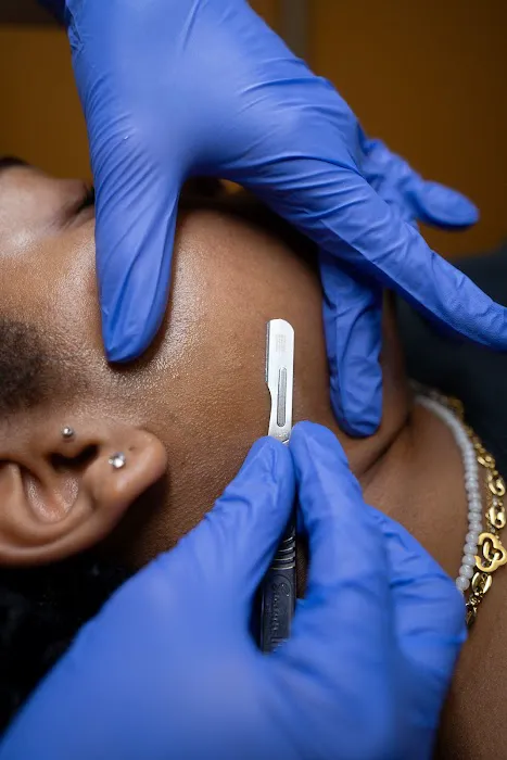 Resolution Acne Studio Picture 6