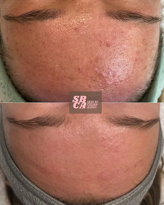 Skin by Cedar Avery Picture 3