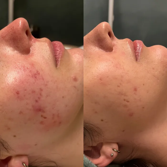 Skin by Cedar Avery Picture 2