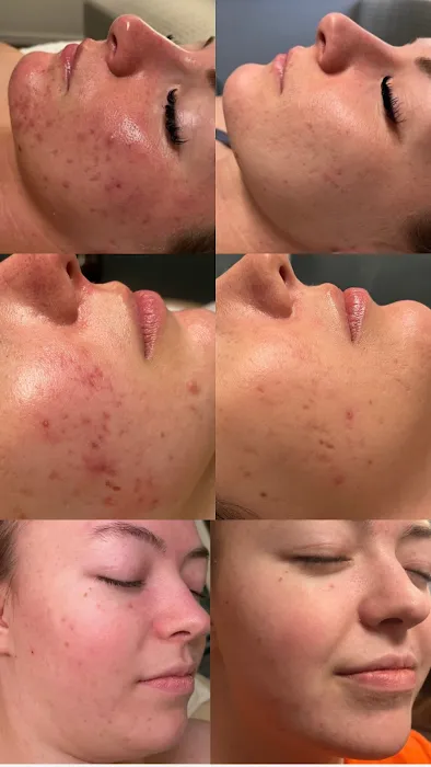 Skin by Cedar Avery Picture 5