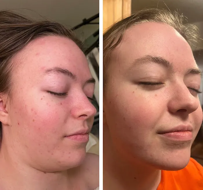 Skin by Cedar Avery Picture 4