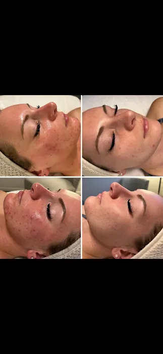 Skin by Cedar Avery Picture 7