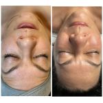 Happy Skin Esthetics