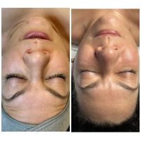 Happy Skin Esthetics ico