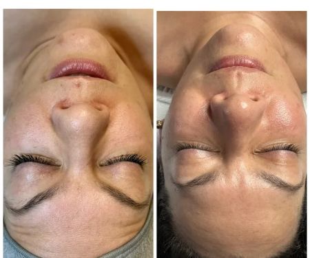 Happy Skin Esthetics