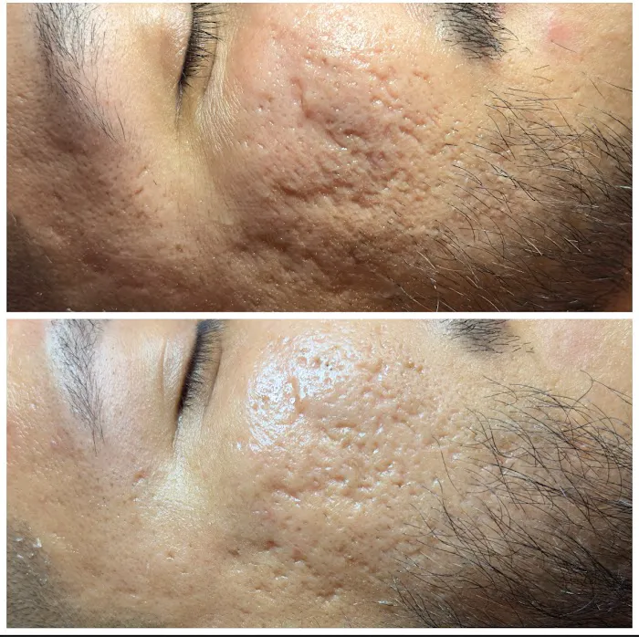 Happy Skin Esthetics Picture 4