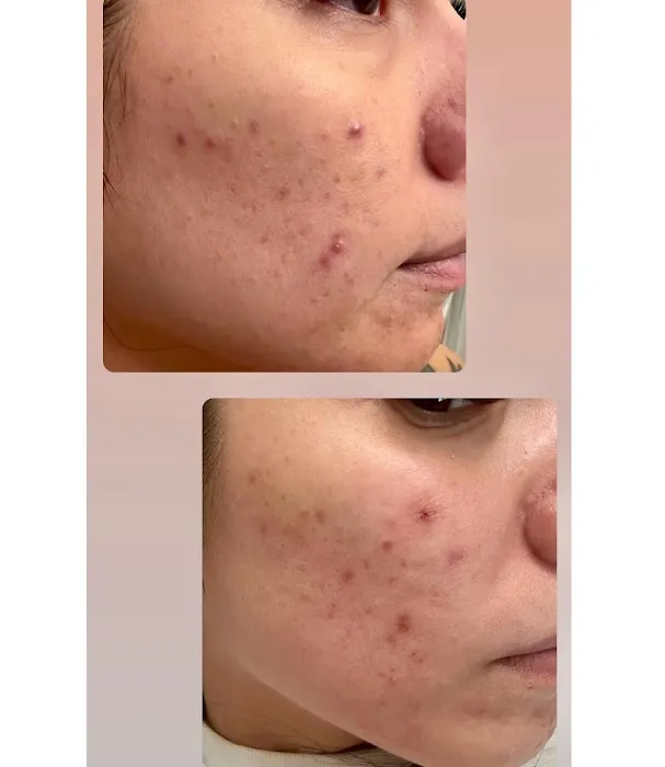 Happy Skin Esthetics Picture 5