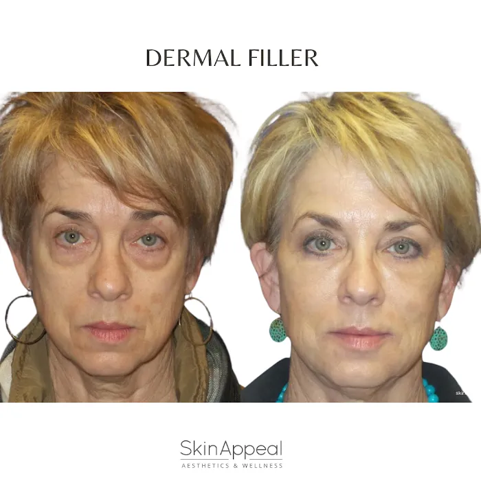 Skin Appeal Picture 9