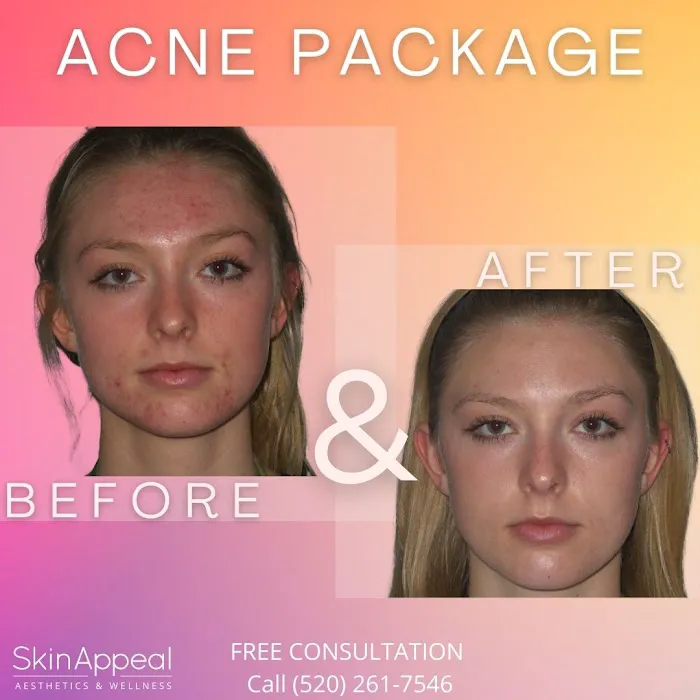 Skin Appeal Picture 10