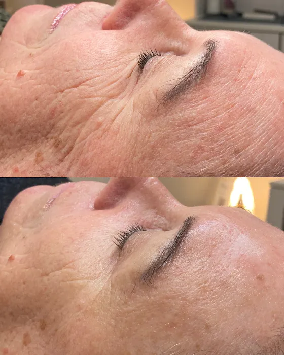 Healthy Skin Aesthetics Picture 8