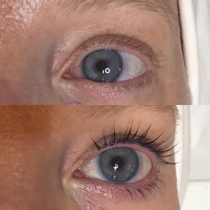 Waxing Moon Esthetics Picture 8