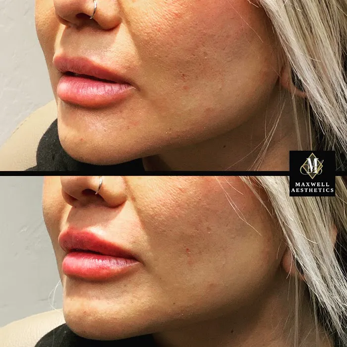 Maxwell Aesthetics Picture 4