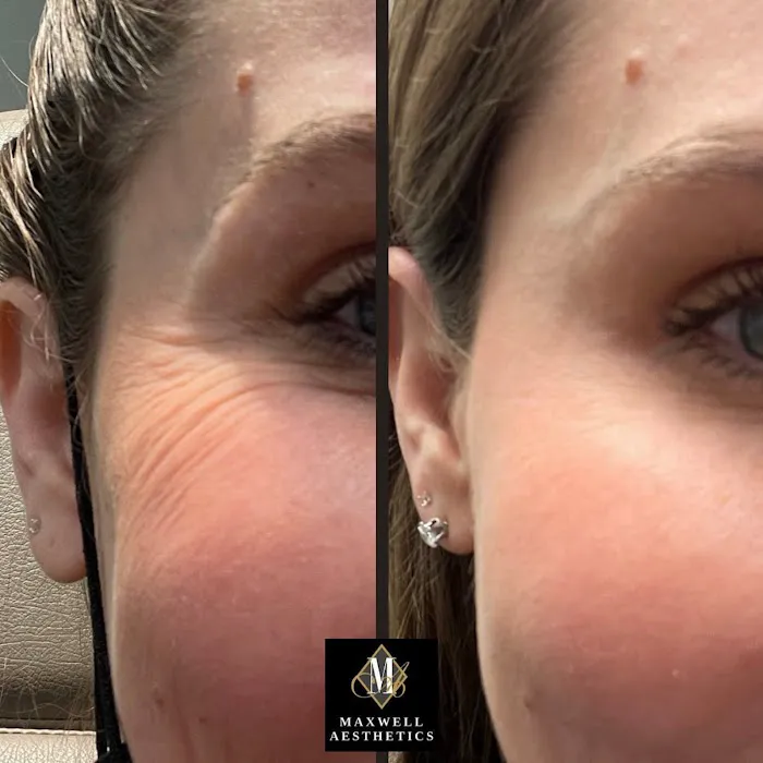 Maxwell Aesthetics Picture 6