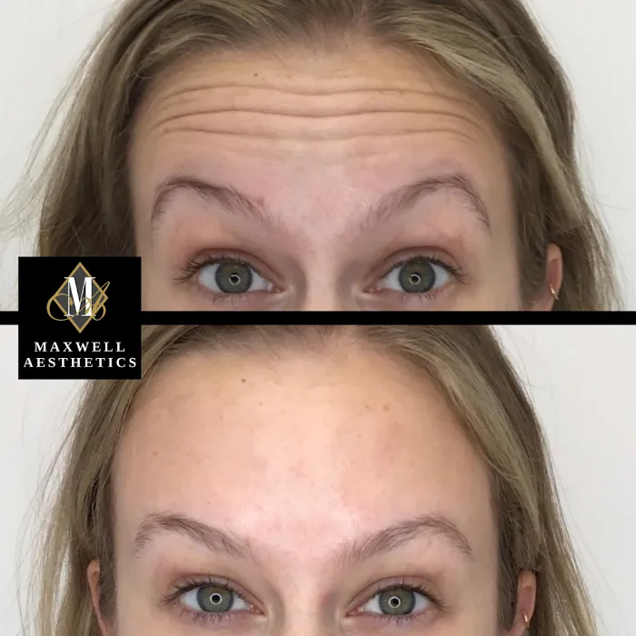 Maxwell Aesthetics Picture 7