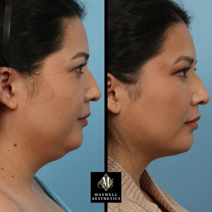 Maxwell Aesthetics Picture 9