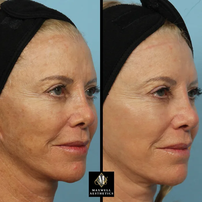 Maxwell Aesthetics Picture 10