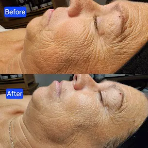 The Fern Grove Spa Picture 4