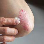 Mountain View Dermatology and Aesthetics