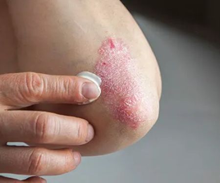 Mountain View Dermatology and Aesthetics