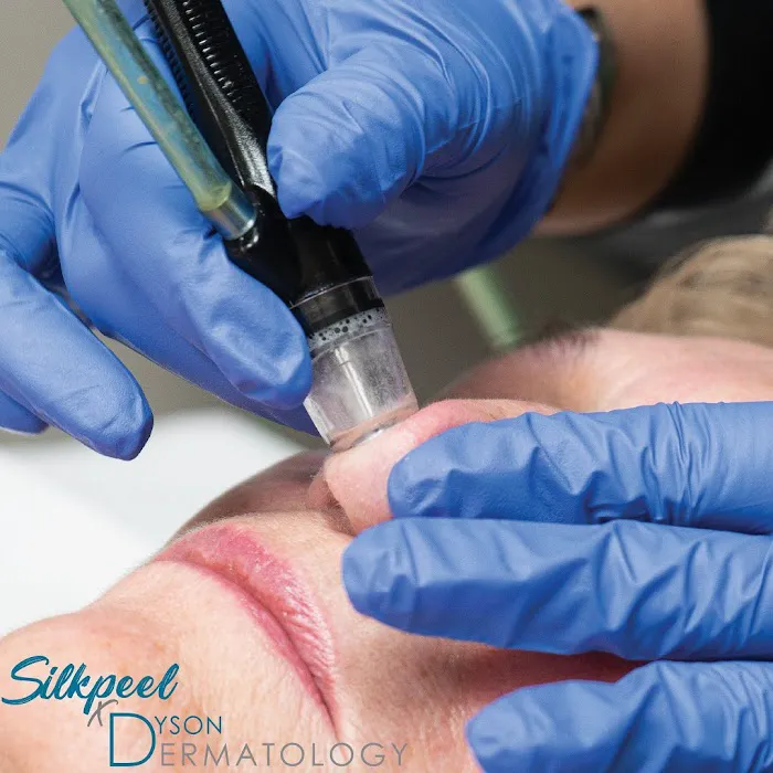 Dyson Dermatology Picture 2