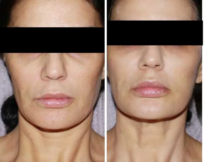 Advanced DermaCare Inc Picture 8