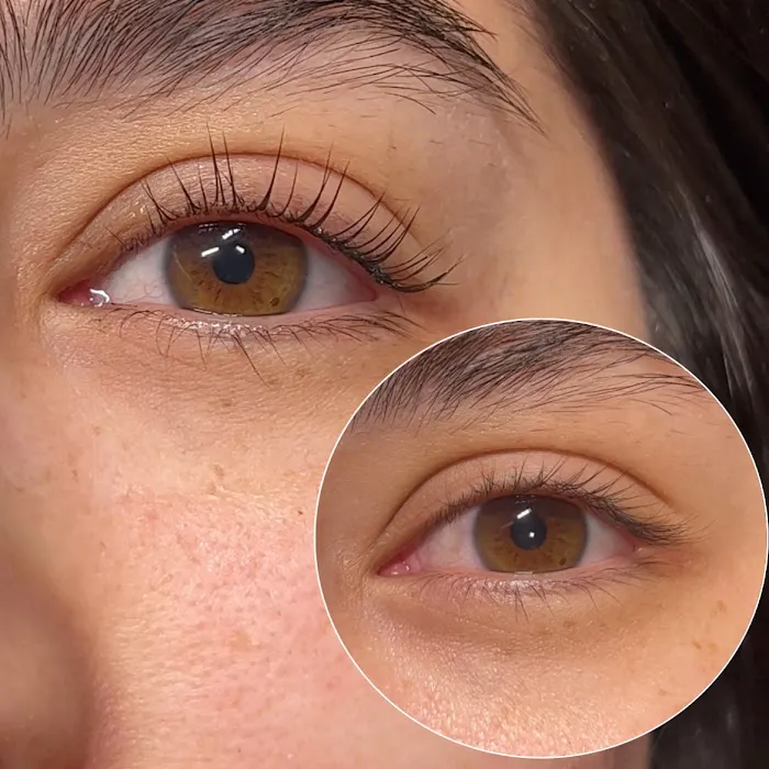 SKNFORM Aesthetics Picture 2