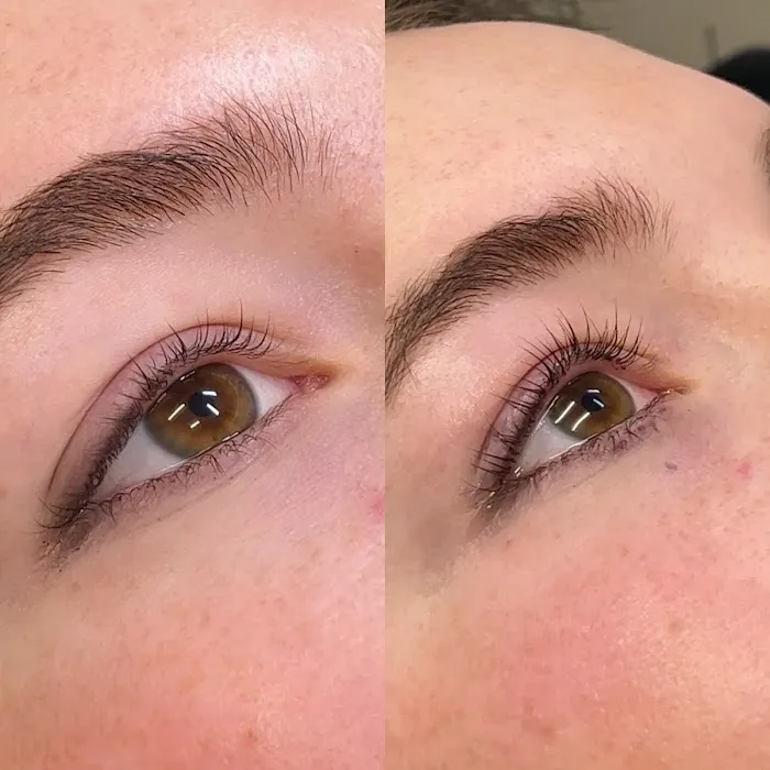 SKNFORM Aesthetics Picture 4