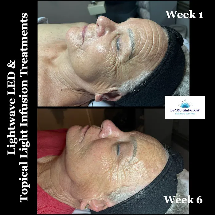 be-YOU-tiful-GLOW Skincare Services Picture 6
