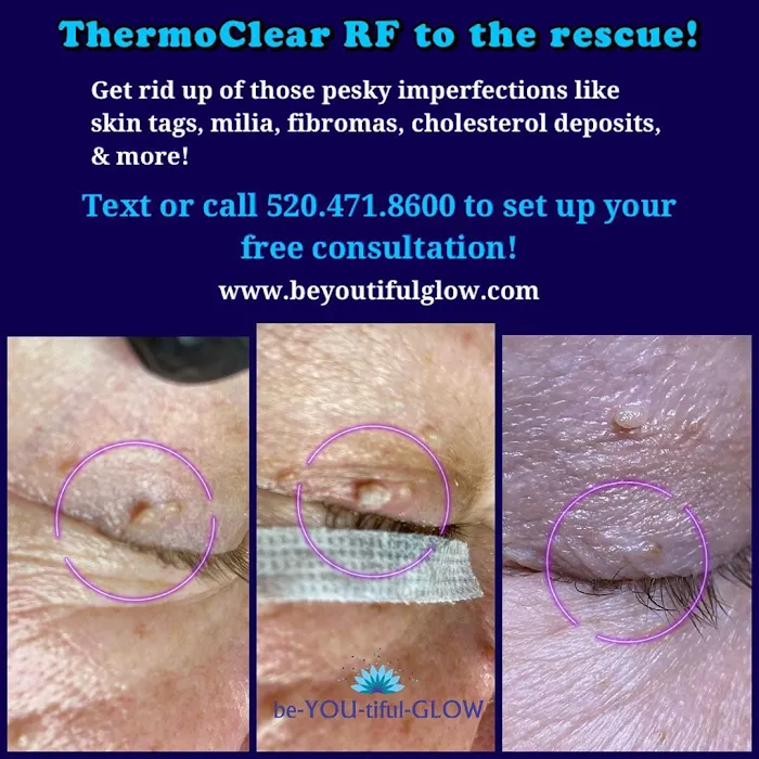 be-YOU-tiful-GLOW Skincare Services Picture 10