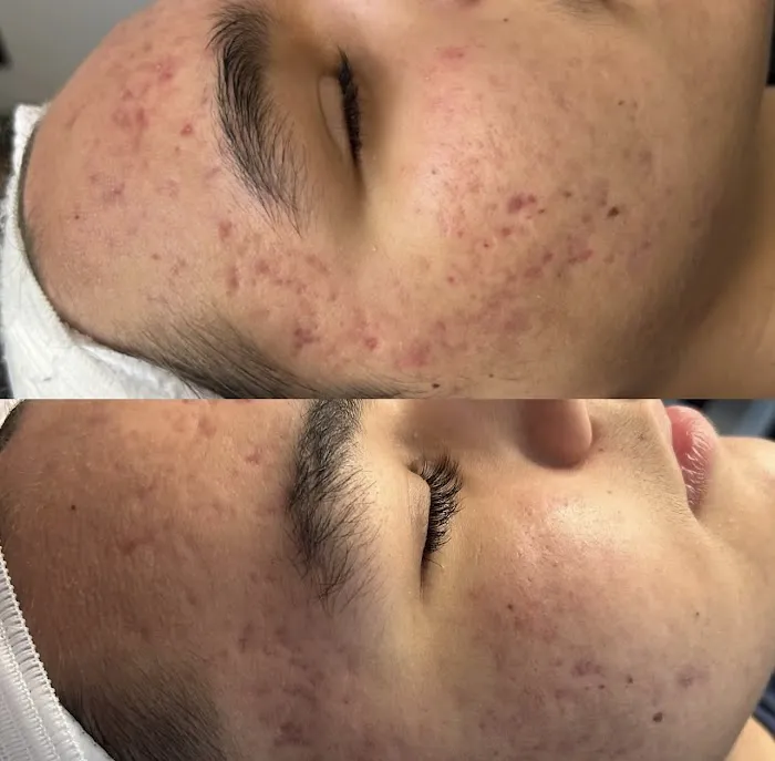 Skinventure - Tucson Acne Specialist Picture 6