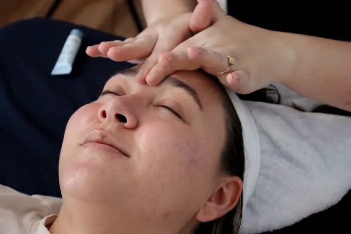 Skinventure - Tucson Acne Specialist Picture 8