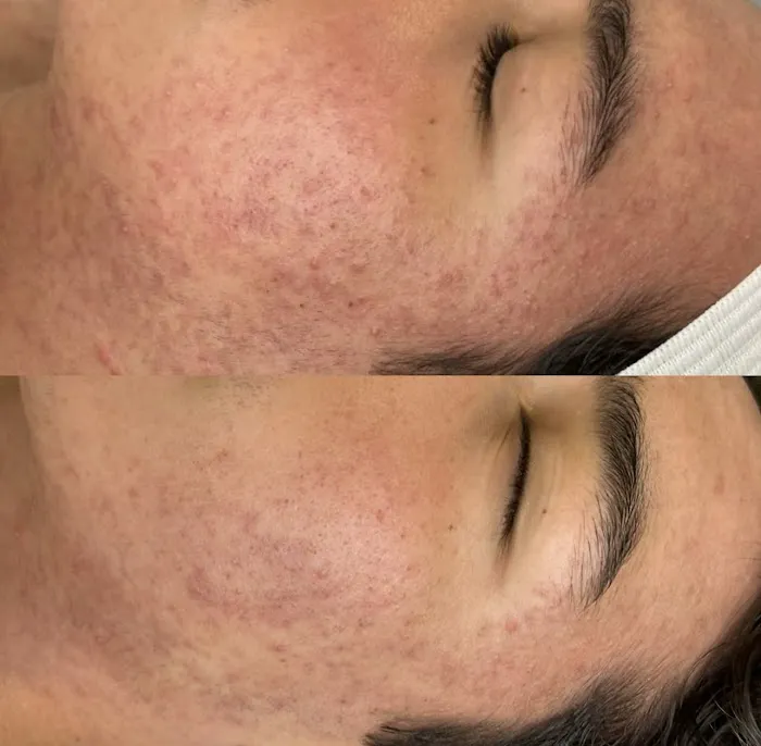 Skinventure - Tucson Acne Specialist Picture 7