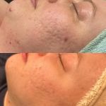 Impressive Aesthetics