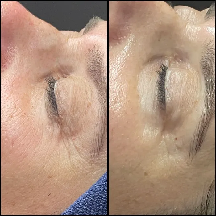 Blue Haven Beauty Picture 7