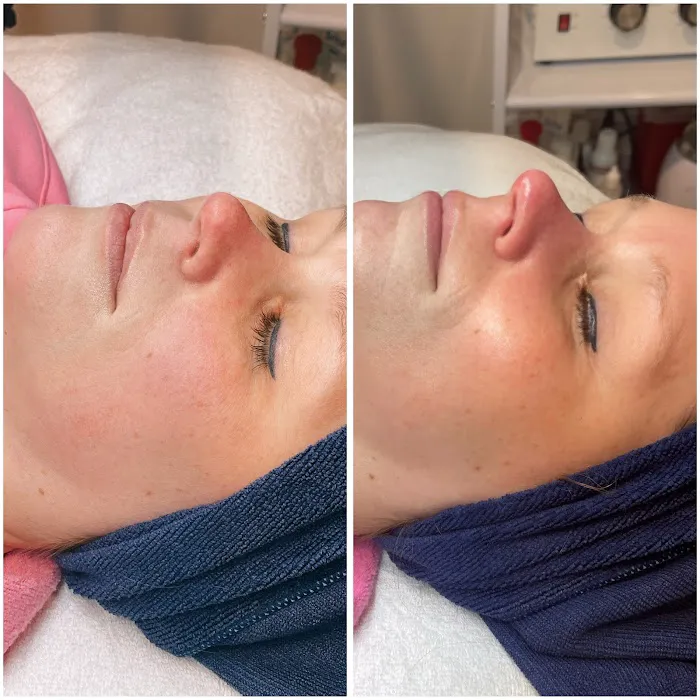 Blue Haven Beauty Picture 6