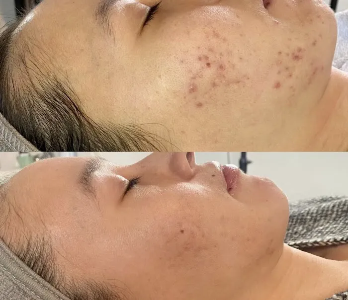 Z-Spot Skincare Picture 7