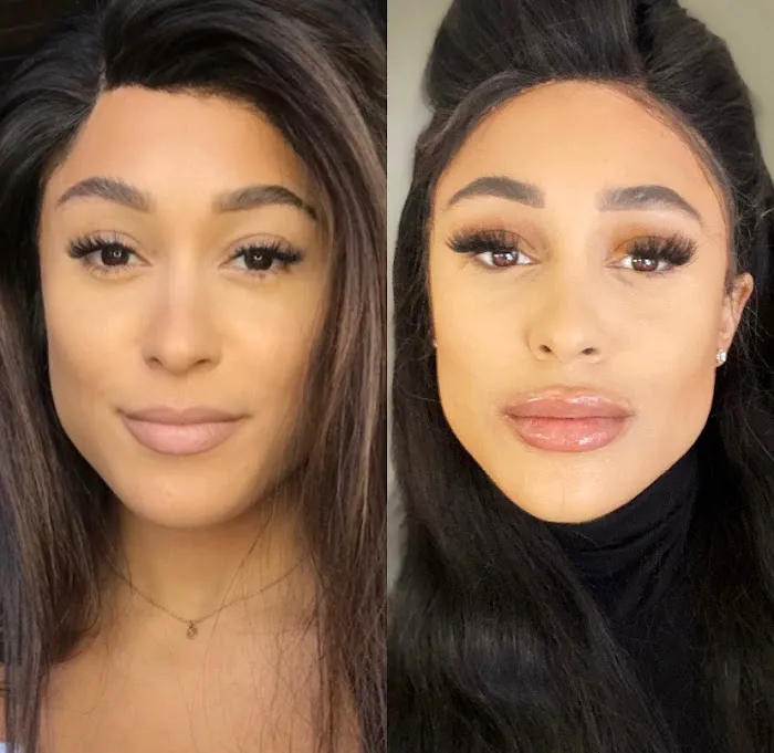 Art Of Injections Picture 7