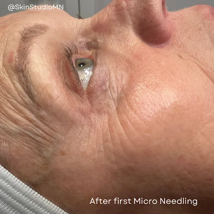 SkinStudioMN Picture 8